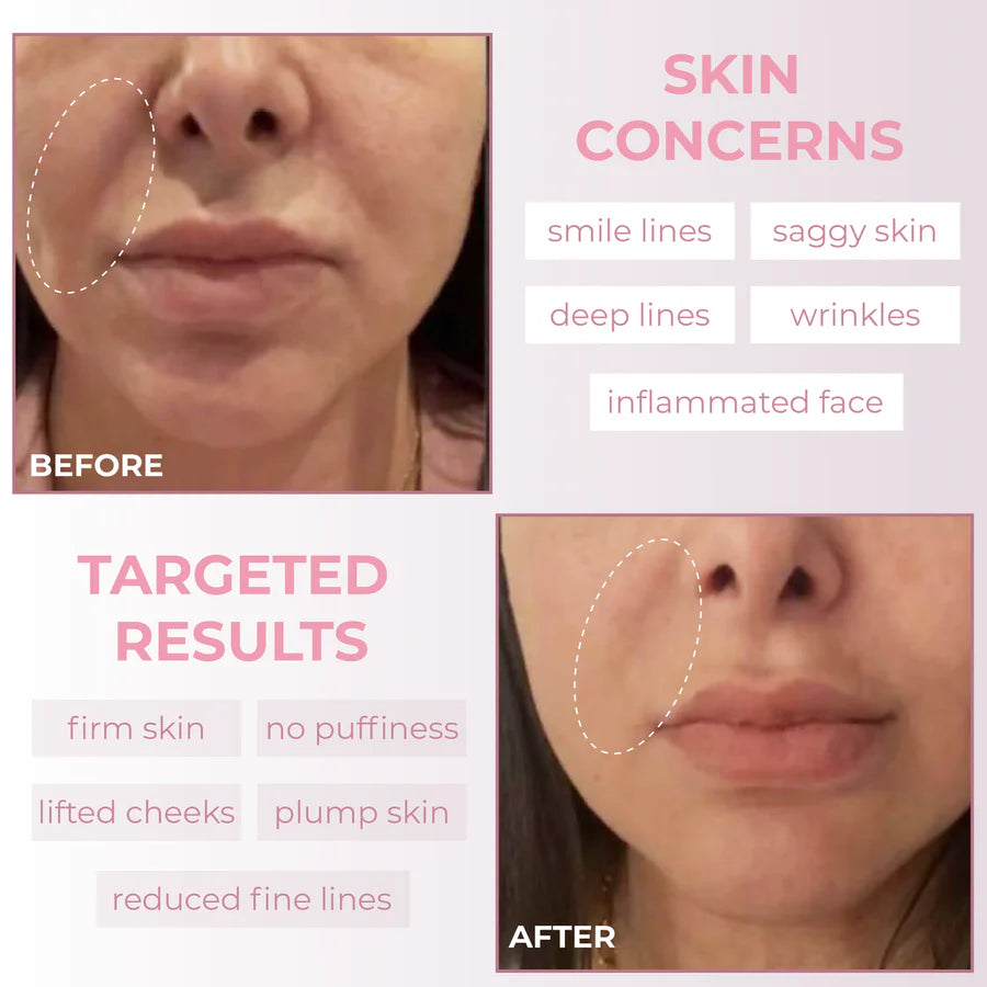 LUMÉRA™ Beauty Face Sculptor